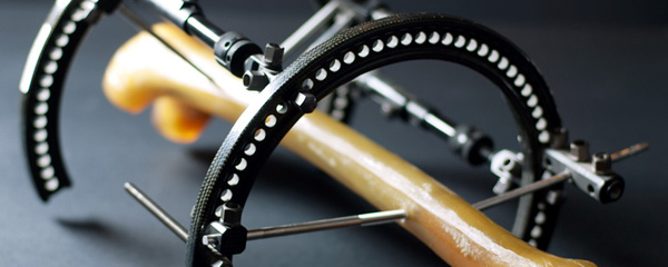 雙螺桿擠出機(jī)的原理相關(guān)知識簡介